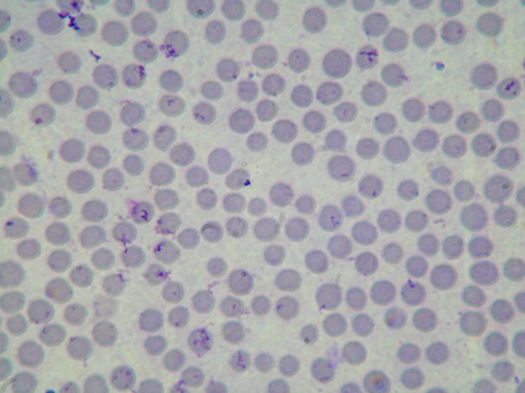 Babesia in Nilgai Babesia in Nilgai